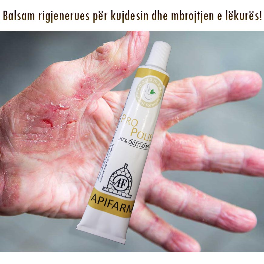 Mehlemi PROPOLIS - Balsam rigjenerues per Ekzeme , Psoriaze, Djegje